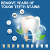 14 Day Teeth Whitening Strips,Treatments Teeth Whitening Kit?Sensitive Teeth Whitening Strips?Enamel Safe Tooth Whitening Strips?Deep Stains Removal