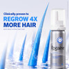 Mens Rogaine 5% Minoxidil for Men Foam, Clinically Proven Regrowth for Thinning Hair, Topical Hair Loss Treatment, Unscented Topical Aerosol, Result