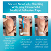 Advanced Silicone Scar Treatment Sheets for OLD, NEW Scars, Surgery, Keloids