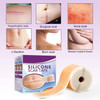 Silicone Scar Tape Roll, 1.6 x 60 Medical Tape for Wound Care Bandages Scars