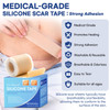 Aroamas Scar Silicone Scar Sheets - Silicone Scar Tape