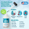 Ebanel Athletes Foot Treatment Extra Strength, Antifungal Cream for Foot Fungus