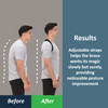 ComfyBrace Posture Corrector-Back Brace for Men and Women- Fully Adjustable