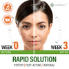 Perfect Skin Acne Pills