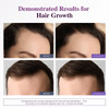 Biotin 10,000MCG Hair Growth Support for Women & Men with Collagen & Keratin