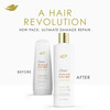 Dove Damage Therapy Derma Conditioner Dryness Itch for Flaky Scalp with Pyrithione Zinc and Coconut Oil 12 Fl Oz