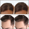 Boobeen Hairline Powder Stick for Thinning Hair TouchUp and Root Concealer for Hair Loss