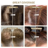 SOVONCARE Hairline Powder Root Touch Up Gray Hair Concealer for Men and Women Instantly Covers Thinning Hair and Bald Sp