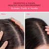 Unwash Balancing Scalp Treatment Serum 25 Fl Oz Pack Of 1