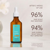 Moroccanoil Dry Scalp Treatment 15 Fl Oz