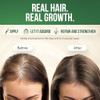 Morstar Batana Oil for Hair Growth Dr Sebi Batana Hair Growth Oil from Honduras 100 Pure Natural ColdPressed for Thicker