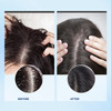 Bablabear Scalp Exfoliator ScrubItchy Scalp Treatment for Dandruff No Sulfate Hair Scrub To Soothe a Dry FlakyScalpRemov