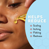 Psoriasis Honey Nourishing Scalp Skin Serum Dry Oil for Skin Full Body Non Comedogenic Moisturizer Daily Dry Scalp Oil H