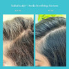 Fable Mane Amla Soothing Serum with Rosemary Oil Purifies and Balances Irritation Detox Treatment for Dry Itchy or Sensi