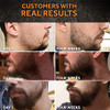 Beard Growth Oil 1Fl Oz Growing Serum That Softens Strengthens Beards and Mustaches Facial Hair Treatment Treatment Infu