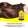 Ginger Hair Growth Serum for Scalp Massage Hair Follicle Treatment Hair Care Germinal Essence Conditioner for Regrowth L