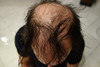 Hair Building Fibers Auburn 25 Grams Refill Your Existing Bottle Highest Grade Fiber By Finally Hair