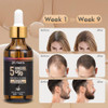5 Minoxidil Hair Growth Treatment for Men and Women Biotin Serum to Prevent Hair Loss and Thinning 2 Pack