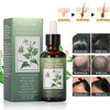Hair Growth Serum for Thicker Longer Fuller Hair Prevents Loss and Thinning with VitaminRich Natural Treatment