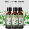 Hair Growth Serum for Thicker Longer Fuller Hair Prevents Loss and Thinning with VitaminRich Natural Treatment