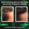 Hair Growth Conditioner Hair Loss Conditioner For Thinning Hair Sulfate Free Prevention Formula Against Hair Loss Alopec