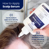 Dermeleve Scalp Serum for Neuropathic Itch Sebborheic Dermatitis Scalp Psoriasis Dry Itchy Leave In Scalp Treatment Quic