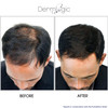 Hair Growth SerumExtra Strength DHT Blocker Stimulates Repairs New Follicle Regrowth Grow Stronger Thicker Fuller Longer