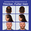 INFINITY Hair Fibers White for Thinning Hair for Women Men 100 Undetectable Hair Building Fiber Powder Conceal Hair Loss