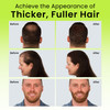 ECLIPSE Hair Fibers Dark Brown for Thinning Hair for Women Men to Conceal Hair Loss in 15 Seconds 100 Undetectable Hair