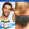 Botanical Capsaicin Anti Hair Loss PreShampoo Treatment With Caffeine Biotin for Hair Thinning Prevention Natural OilFre