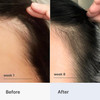 Better Not Younger Hair Thickening Serum for Women Over 40 Scalp Care Hair Density Treatment and AntiAging 2floz Fortify