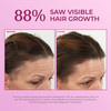 BosleyMD Hair Regrowth Treatment Regular Strength By for Women 2 X 2 Oz Treatment 2count
