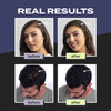 Toppik Hair Building Fibers Black 55g Fill In Fine or Thinning Hair Instantly Thicker Fuller Looking 9 Shades for Men Wo
