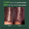 Rene Furterer Triphasic Progressive Concentrated Serum for Hereditary Hormonal Thinning Hair DrugFree Receding Hairline