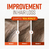 CRAZY SKIN German Beers Yeast Biotin Shampoo for Antihair loss and ThickeningGentle Exfoliating Scalp Function with Pant