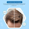 Tricovit Hair Growth Supplement Nail Hair Health Vitamins with Amino Acids Minerals Antioxidants DermatologistFormulated