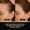 ThickTails Hair Growth Serum for Women with Biotin and Caffeine Leave In Root Stimulating Scalp Serum Lightweight Hair T