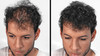 MAXX PROSERIES Volumizing Hair Fibers with real Keratin for Thinning HairHair Loss Dermatologist Tested and Certified Hy