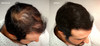 MAXX PROSERIES Volumizing Hair Fibers with real Keratin for Thinning HairHair Loss Dermatologist Tested and Certified Hy