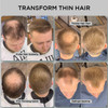 THICK FIBER Hair Fibers for Thinning Hair Bald spots LIGHT BROWN 25g Bottle Conceals Hair Loss in Seconds Hair Powder fo
