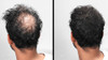 LUXE Hair Building Fibers Thickening Fibers CONFIDENCE IN A JAR 2 Months Supply Hypoallergenic Dermatologist Tested Mult