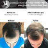 Biotin Vitamin Hair Conditioner for Thinning Hair Moisturizing Conditioner with Aloe Vera and Cucumber Conditioning Trea