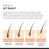 Minimalist Hair Density Serum 18 With Procapil Capixyl Redensyl Anagain Baicapil For Hair Fall Control Women Men 30 ml