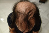 Hair Building Fibers 100 Grams Refill Your Existing Bottle Highest Grade Fiber By Finally Hair Sandy Blonde