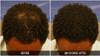 Dr Yates MD Keratin Fiber Hair Enhancer Dark Brown