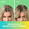 OGX Extra Strength Refreshing Scalp Teatree Mint Shampoo Invigorating Scalp Shampoo with Tea Tree Peppermint Oil Witch H