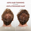 Klorane Strengthening Shampoo with Quinine DermatologistTested Natural Alternative Thickening Shampoo for Hair Thinning