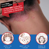 Tarsum Extra Strength Psoriasis Shampoo Coal Tar Shampoo and Conditioner for Scalp Psoriasis Seborrheic Dermatitis Sever