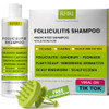 Folliculitis Shampoo Antifungal Shampoo for Seborrheic Dermatitis Scalp Psoriasis Dandruff Soothes Itchy Dry Scalp Clean