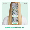 TS GD Shampoo for Flake Prone Uncomfortable Scalp 141 Fl Oz For Youth Teens Gentle ScalpCare Routine Silicone SLS SLES F